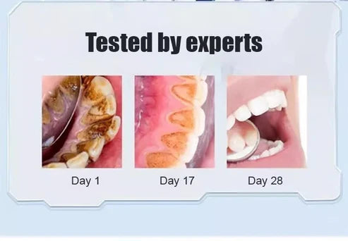 Whitening  Toothpaste         ( BUY 1 GET ONE FREE )